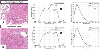 吸收/透射/反射