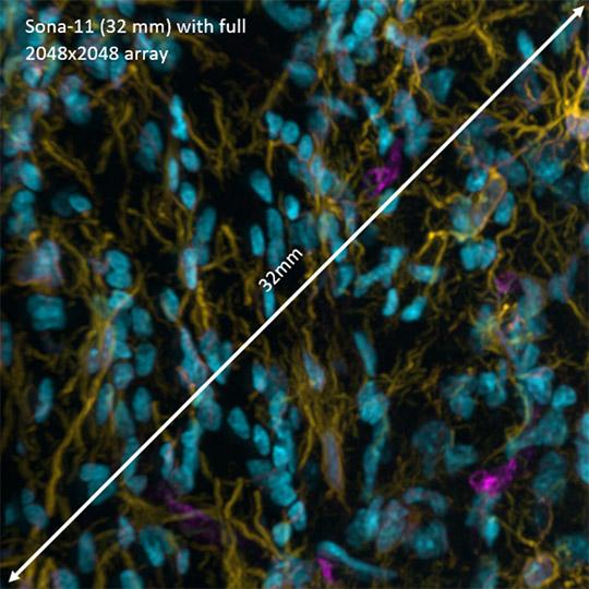 Sona sCMOs，配备2048×2048全阵列