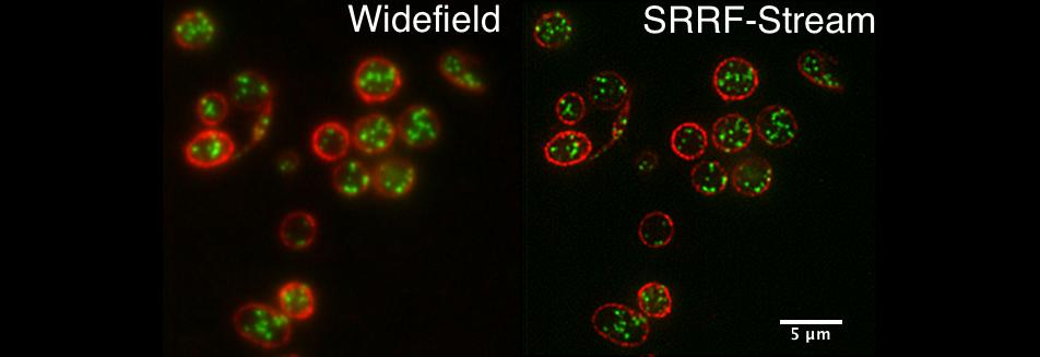 血小板的标准宽场与宽场 SRRF-Stream+ 图像对比，红色为细胞膜，绿色为内部的颗粒。样本由伦敦大学学院的 Cutler 实验室提供。